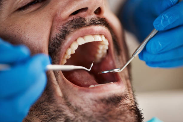 Best Broken or Cracked Tooth Emergency Dentist in Karns, TN